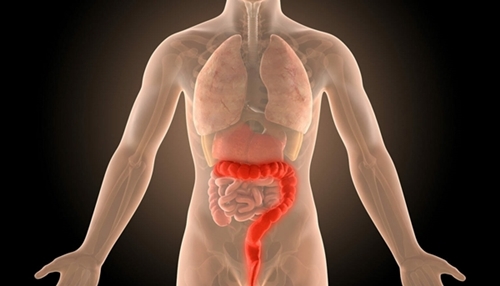 Colitis picture