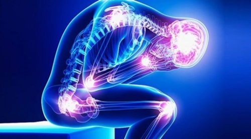 Fibromyalgia picture