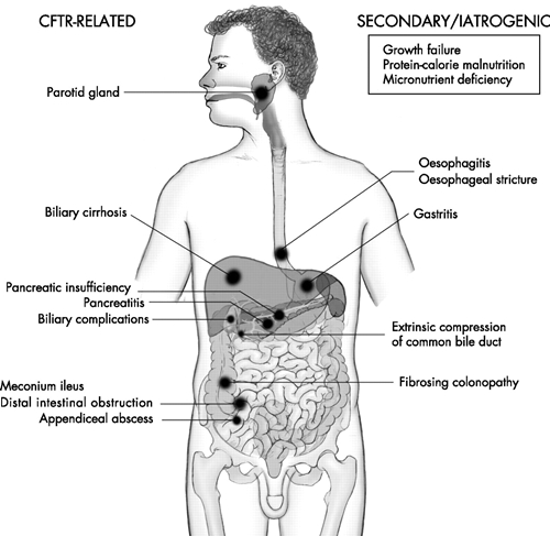 GI ailments picture