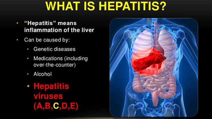 Hepatitis picture