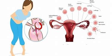Menstrual cramps picture