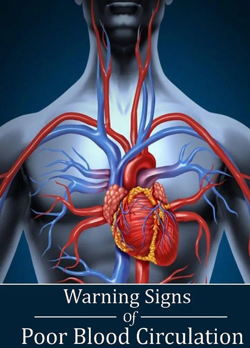 Poor blood circulation picture