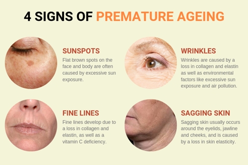 Premature ageing picture